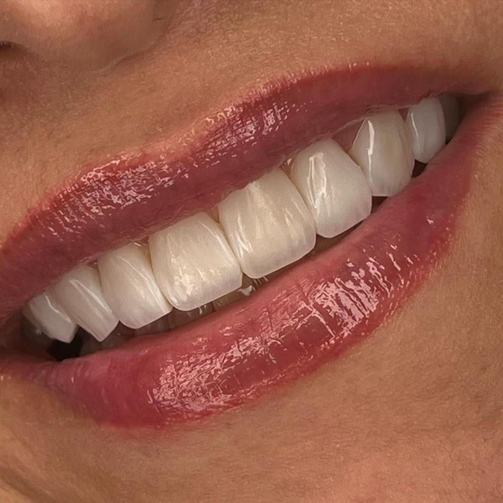 کلینیک کامپوزیت دندان در پردیس